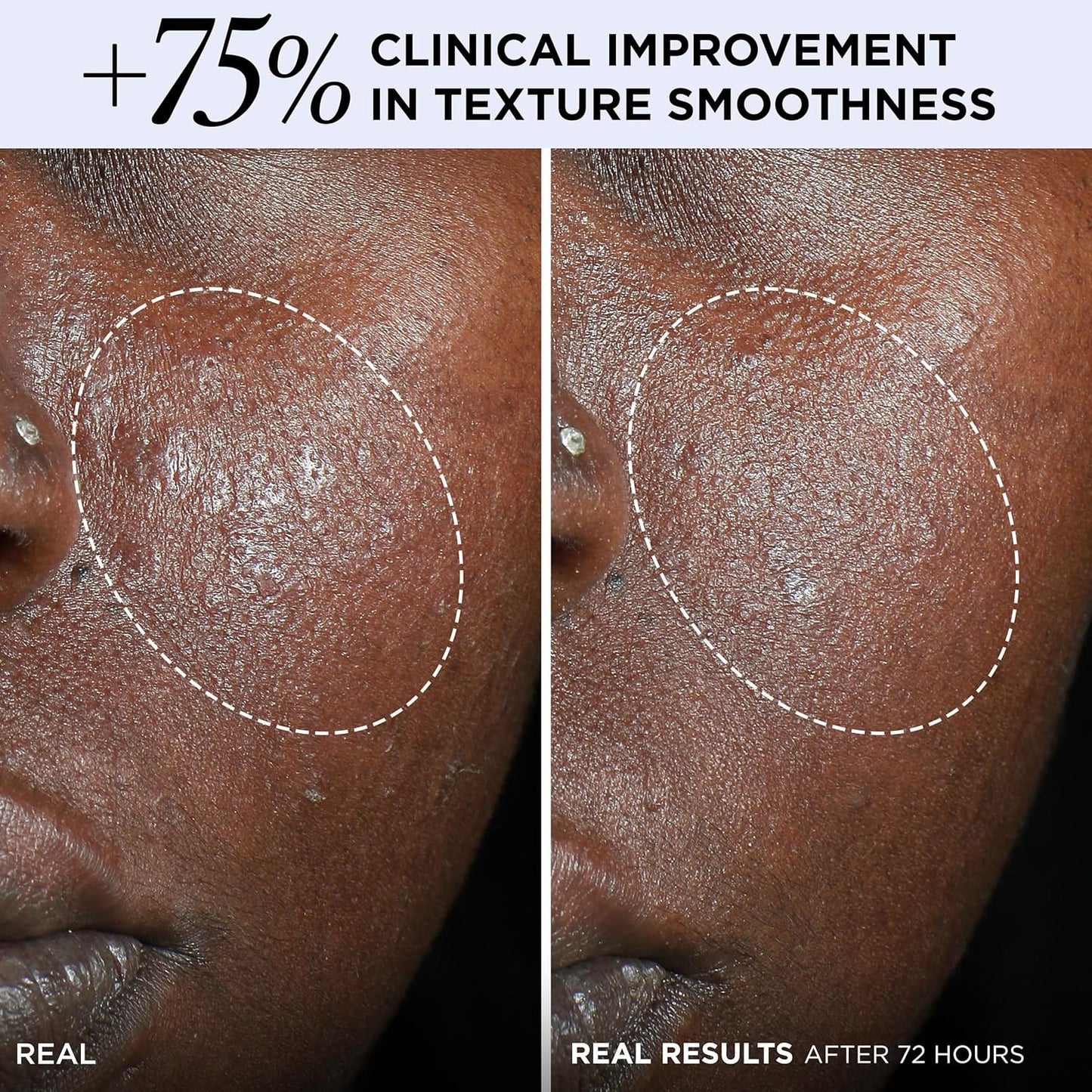 IT Cosmetics Confidence in a Cream Barrier Boost - Skin Barrier Repair Daily Face Moisturizer - Clinically Smoother, Softer Skin After 1 Use - Fragrance-Free, 100HR Hydration with Ceramide